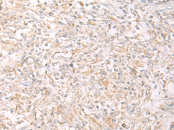 Rabbit Polyclonal Antibody to IL12B