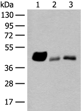 Rabbit Polyclonal Antibody to HLA-A/B/C