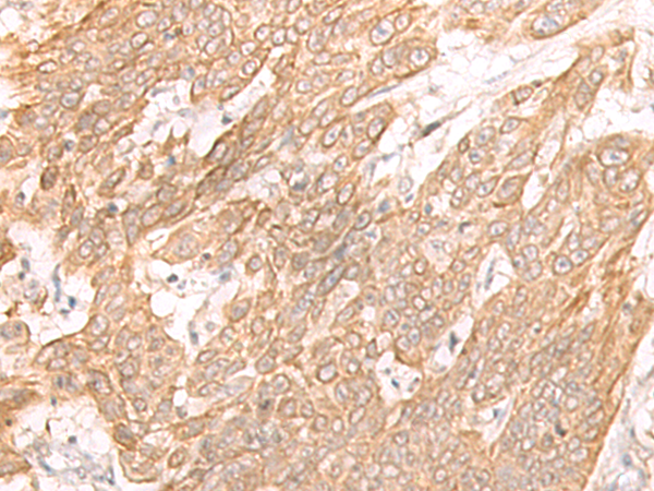Rabbit Polyclonal Antibody to IFNL1