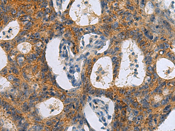 Rabbit Polyclonal Antibody to FBXO32