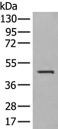 Rabbit Polyclonal Antibody to HLA-A
