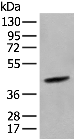 Rabbit Polyclonal Antibody to HLA-B