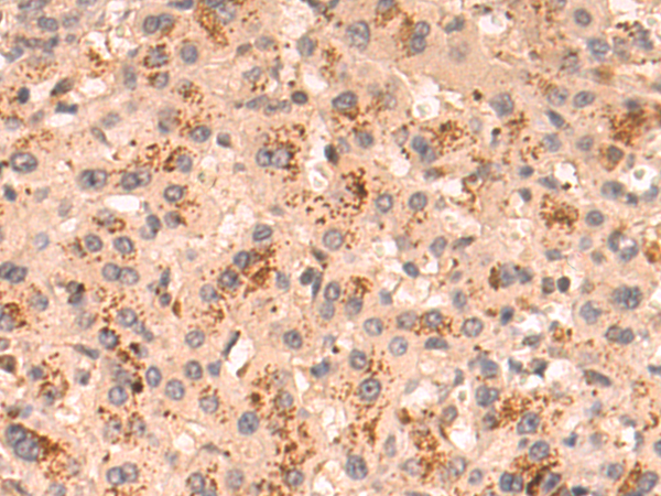 Rabbit Polyclonal Antibody to HLA-C