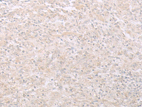 Rabbit Polyclonal Antibody to EPS15