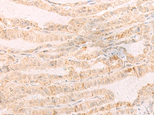 Rabbit Polyclonal Antibody to EREG