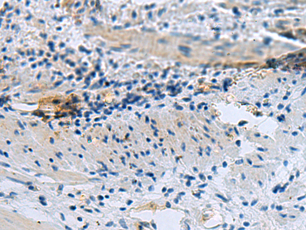 Rabbit Polyclonal Antibody to GSPT1