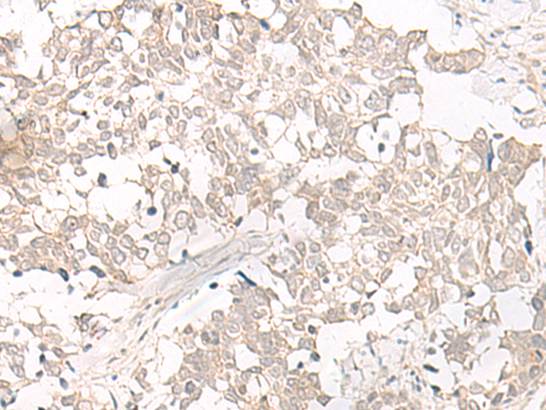Rabbit Polyclonal Antibody to ESPN