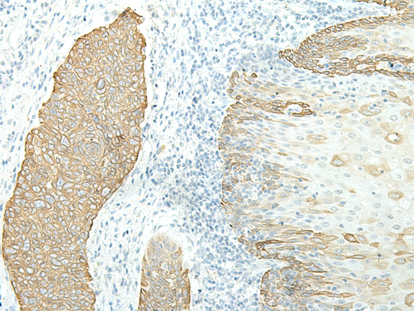 Rabbit Polyclonal Antibody to ETAA1