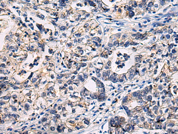 Rabbit Polyclonal Antibody to ADGRL4