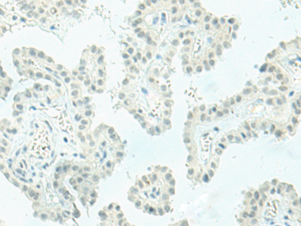 Rabbit Polyclonal Antibody to ETV2