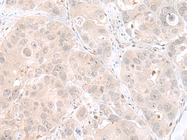 Rabbit Polyclonal Antibody to ETV3