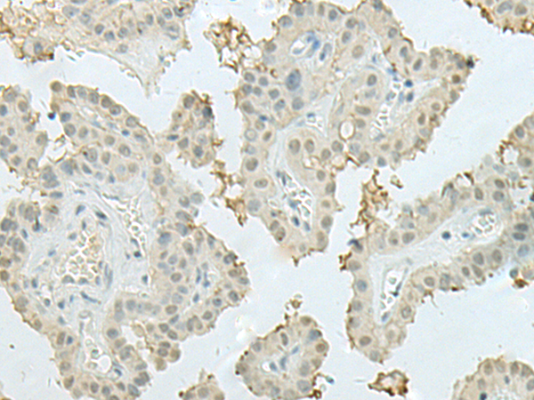 Rabbit Polyclonal Antibody to MECOM