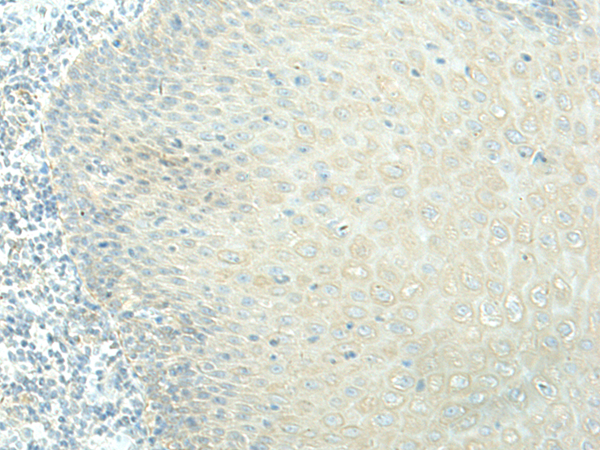Rabbit Polyclonal Antibody to EVI2B