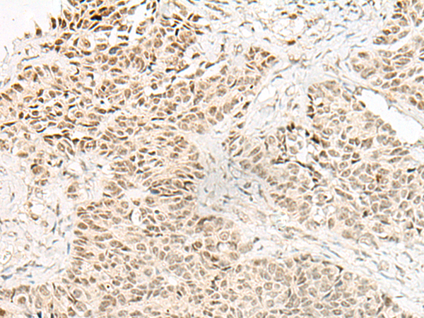 Rabbit Polyclonal Antibody to EVX1