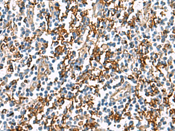 Rabbit Polyclonal Antibody to HLA-DRA