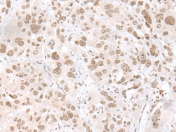 Rabbit Polyclonal Antibody to EHMT2