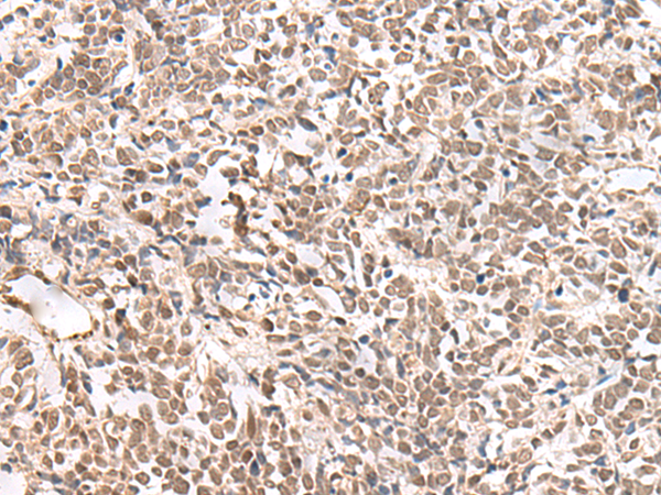 Rabbit Polyclonal Antibody to ZNF560