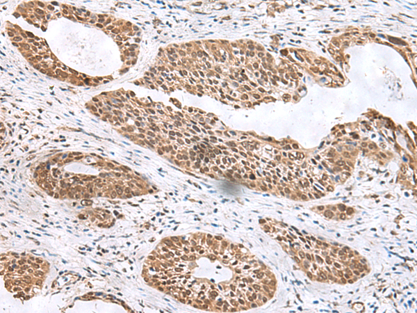 Rabbit Polyclonal Antibody to EXD2