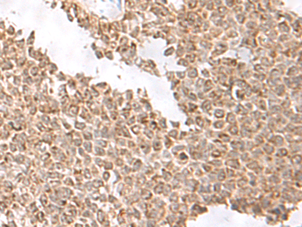 Rabbit Polyclonal Antibody to USP16