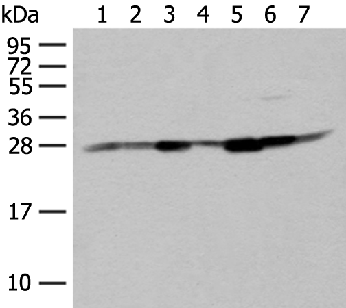 Rabbit Polyclonal Antibody to NIPSNAP2