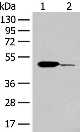 Rabbit Polyclonal Antibody to ACOD1