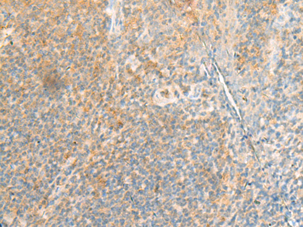 Rabbit Polyclonal Antibody to LAMTOR1