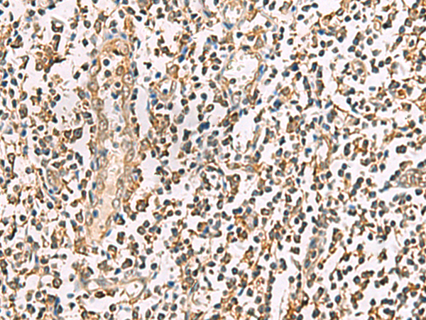 Rabbit Polyclonal Antibody to P3H2