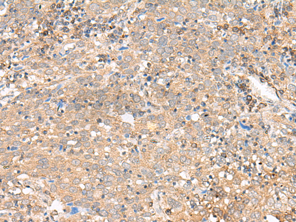 Rabbit Polyclonal Antibody to F13B