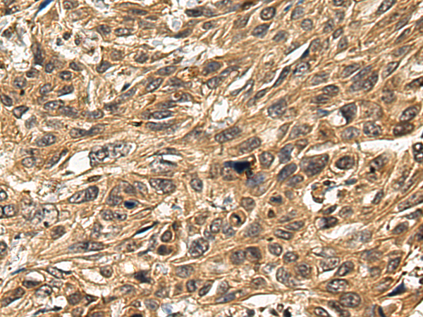 Rabbit Polyclonal Antibody to FAM177B