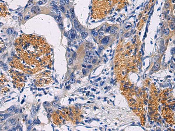Rabbit Polyclonal Antibody to FAM20C