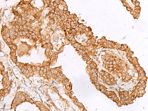 Rabbit Polyclonal Antibody to FAM200A