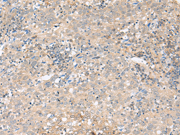 Rabbit Polyclonal Antibody to PIEZO2