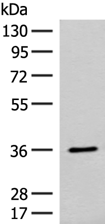 Rabbit Polyclonal Antibody to LRATD1