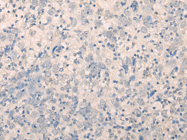 Rabbit Polyclonal Antibody to FAM91A1