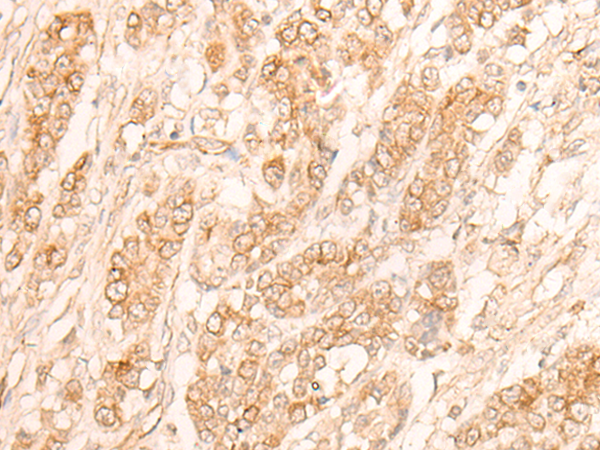 Rabbit Polyclonal Antibody to FAN1