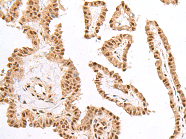 Rabbit Polyclonal Antibody to KDM2A