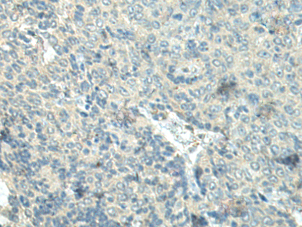 Rabbit Polyclonal Antibody to FBXL16