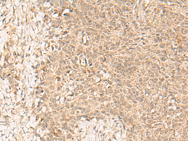 Rabbit Polyclonal Antibody to FBXL4