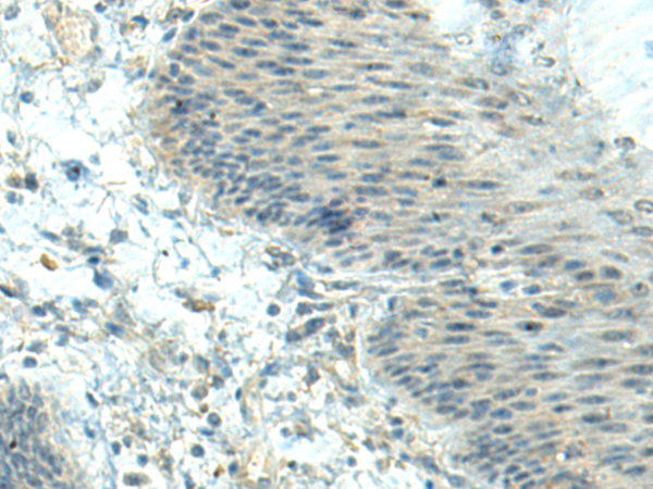 Rabbit Polyclonal Antibody to CTDP1
