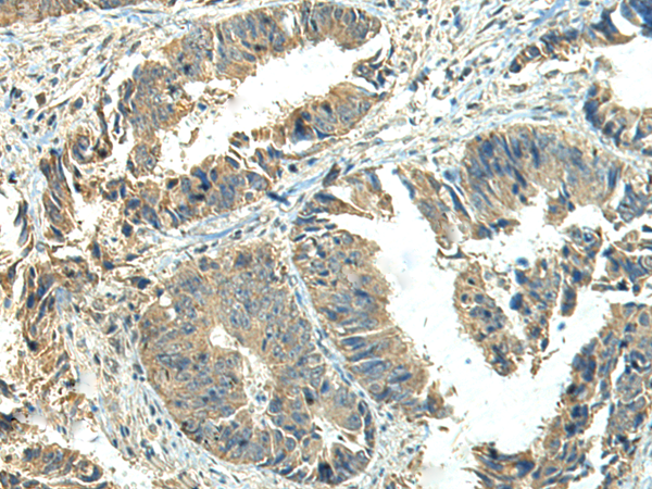 Rabbit Polyclonal Antibody to NPVF