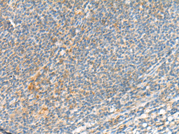Rabbit Polyclonal Antibody to TSHB