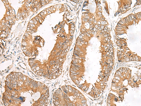 Rabbit Polyclonal Antibody to FERD3L