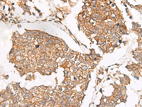 Rabbit Polyclonal Antibody to SLC40A1