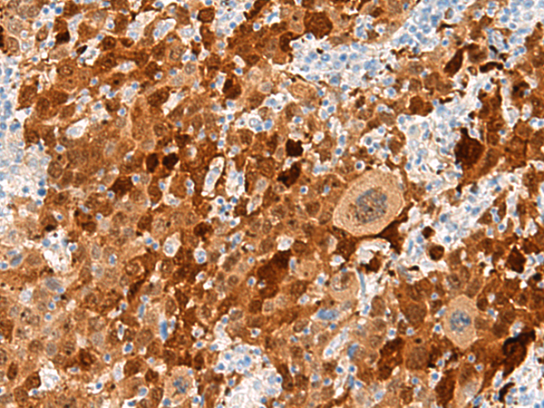 Rabbit Polyclonal Antibody to FGD3