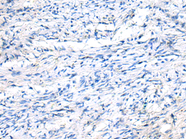 Rabbit Polyclonal Antibody to FGF11