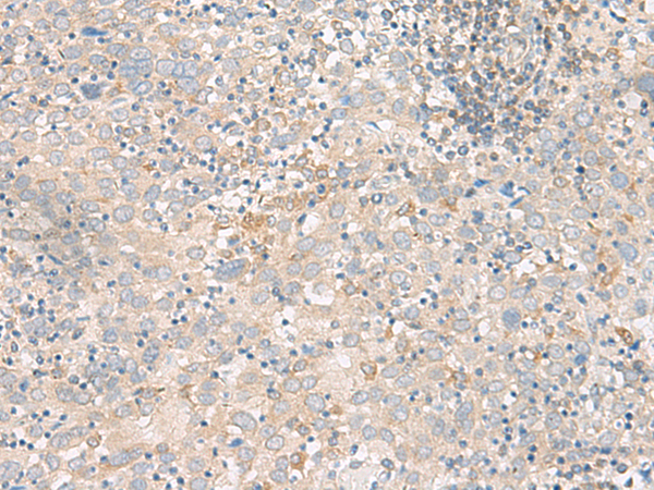 Rabbit Polyclonal Antibody to FGF13