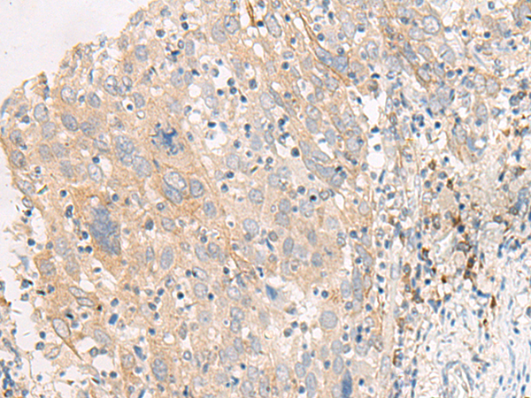 Rabbit Polyclonal Antibody to FGF19