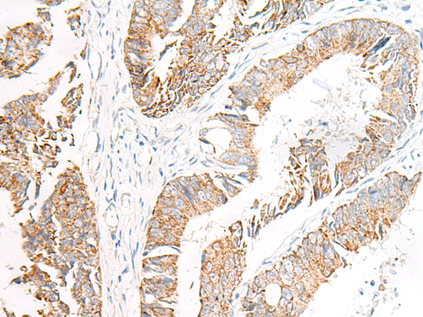 Rabbit Polyclonal Antibody to FGR