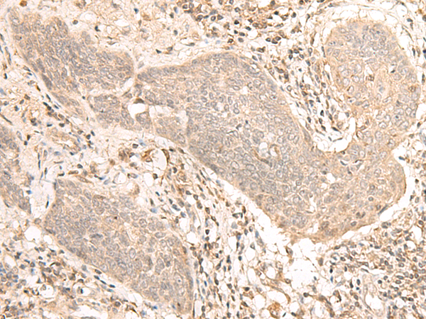 Rabbit Polyclonal Antibody to VPS50