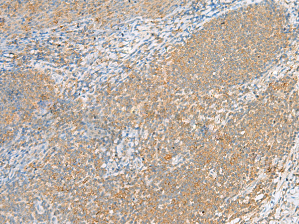 Rabbit Polyclonal Antibody to FOLR1